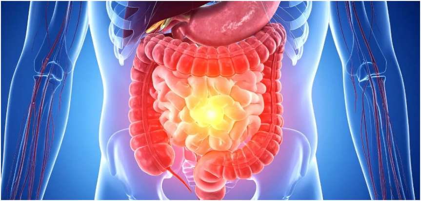 how diet affects gut bacteria